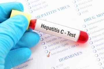 You Could Have the Deadly Virus HEP C and Not Know It